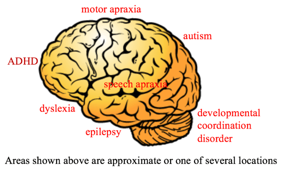 Neuro Developmental Disorders Neuroneeds